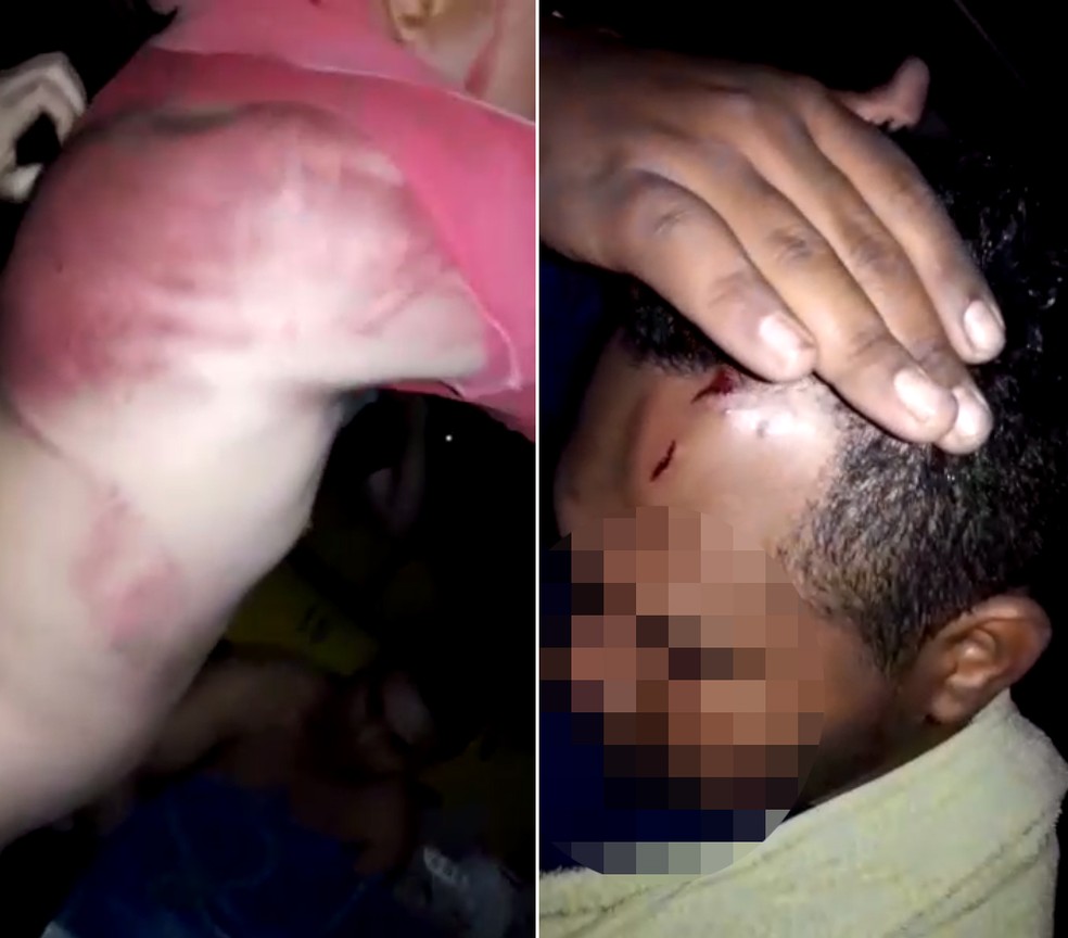 Passageiros foram agredidos violentamente pelos bandidos. (Foto: Arquivo pessoal)