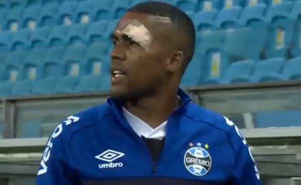 Douglas Costa cai no hotel do Grêmio, tem corte no supercílio e leva pontos