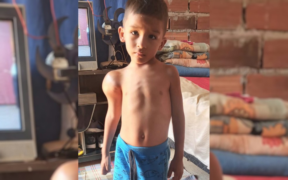 Everthon Gabriel Barbosa Pina, de 3 anos, mora em Aparecida de Goiânia e aguarda vaga de cirurgia em Goiás — Foto: Arquivo Pessoal/Gabriela Barbosa