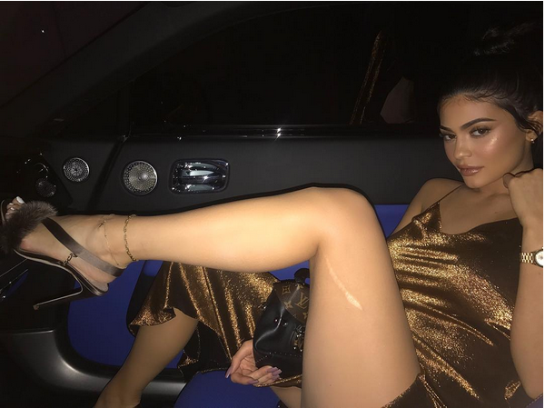 A celebridade Kylie Jenner exibe sua cicatriz (Foto: Instagram)