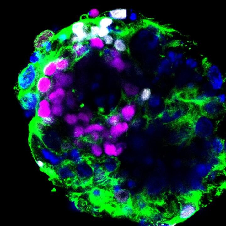 A análise dos padrões de expressão gênica nesses embriões revela que o ACE2, receptor do vírus Sars-CoV-2, e a protease TMPRSS2, que facilita a infecção viral, são expressos em embriões que representam os estágios iniciais da gravidez. (Foto: Zernicka-Goetz lab)