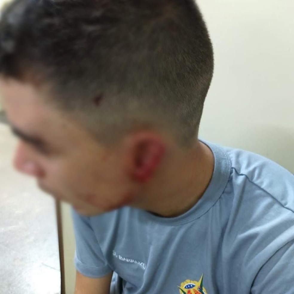 Cadeirante morde e arranca parte da orelha de PM em abordagem no DF — Foto: Polícia Militar/Divulgação