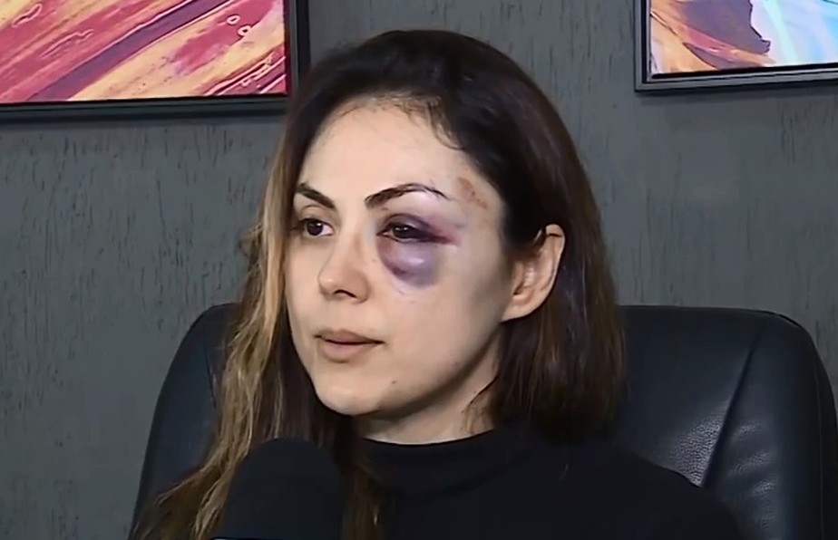 'Ele tem que saber que h&aacute; limites': procuradora espancada por colega em SP diz que pretende process&aacute;-lo