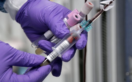 Pesquisadores criam exame de sangue que poderia diagnosticar câncer