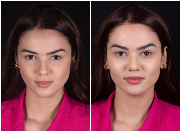 Antes e depois de harmonização facial de Eslovênia, do BBB22 (Foto: Divulgação)