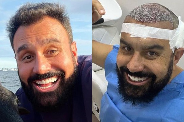 O antes e o depois de Fábio Ramalho (Foto: Reprodução/ Instagram)
