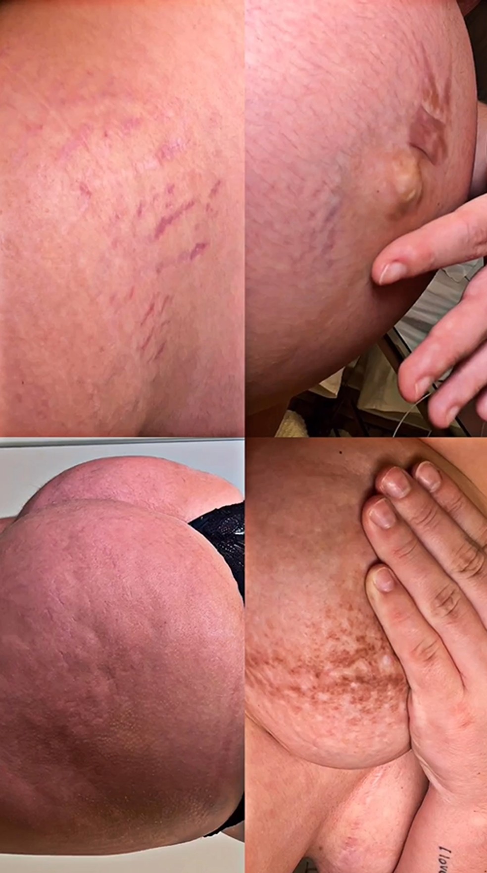 Viih Tube mostra marcas da gravidez no corpo — Foto: Reprodução Instagram