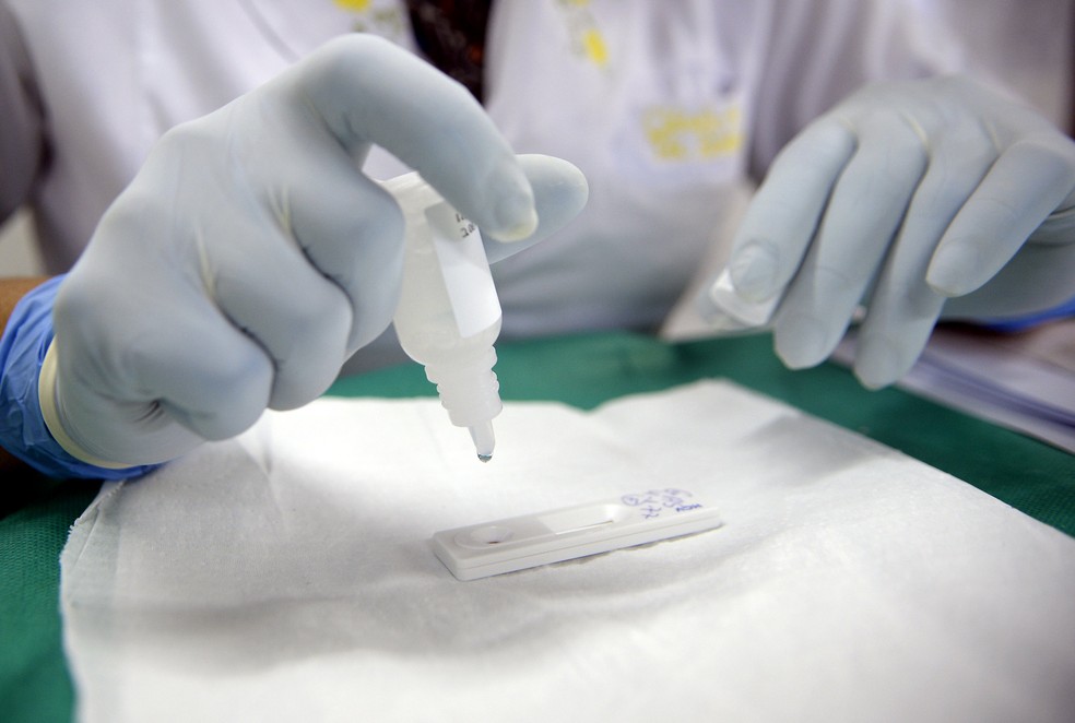Teste para coronavírus aplicado pela Secretaria de Saúde do Distrito Federal — Foto: Matheus Oliveira/Saúde-DF