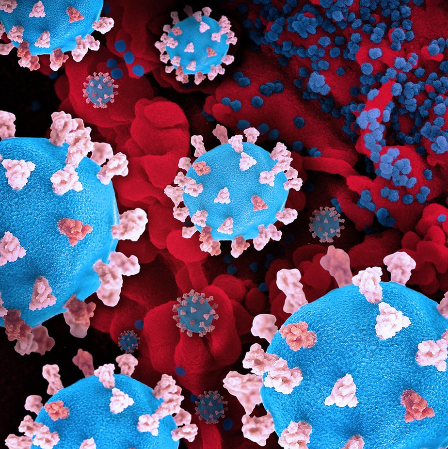 Ilustração do Sars-CoV-2, exibindo impressões 3D de partículas de vírus (azul) e uma imagem de fundo que é um micrografia eletrônica de varredura colorida de uma célula (vermelho)