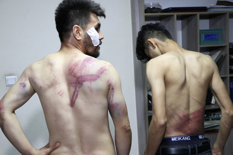 Jornalistas mostram ferimentos após serem espancados pelo Talibã em Cabul, Afeganistão. Foto tirada em 8 de setembro de 2021 — Foto: Etilaatroz/via Reuters