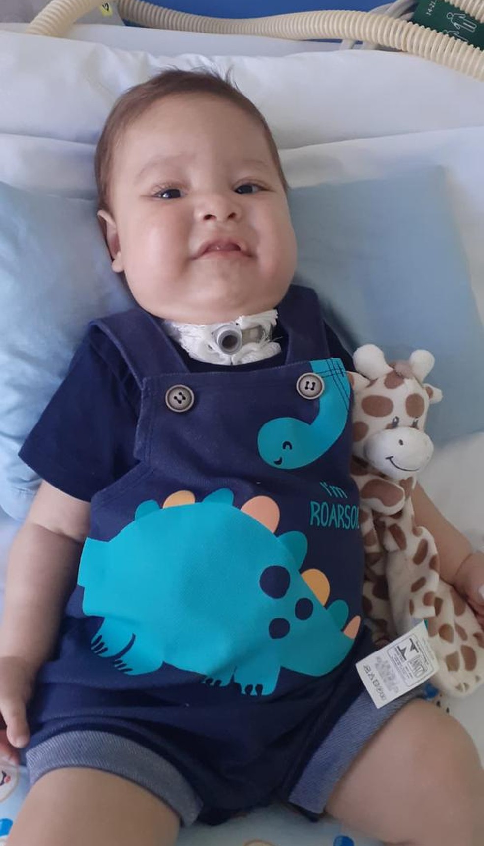 Adrian Emanuel foi diagnosticado com AME quando tinha 4 meses de vida. — Foto: Cedida