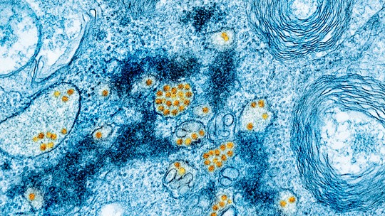 SP identifica primeiro caso de febre amarela no estado desde 2020