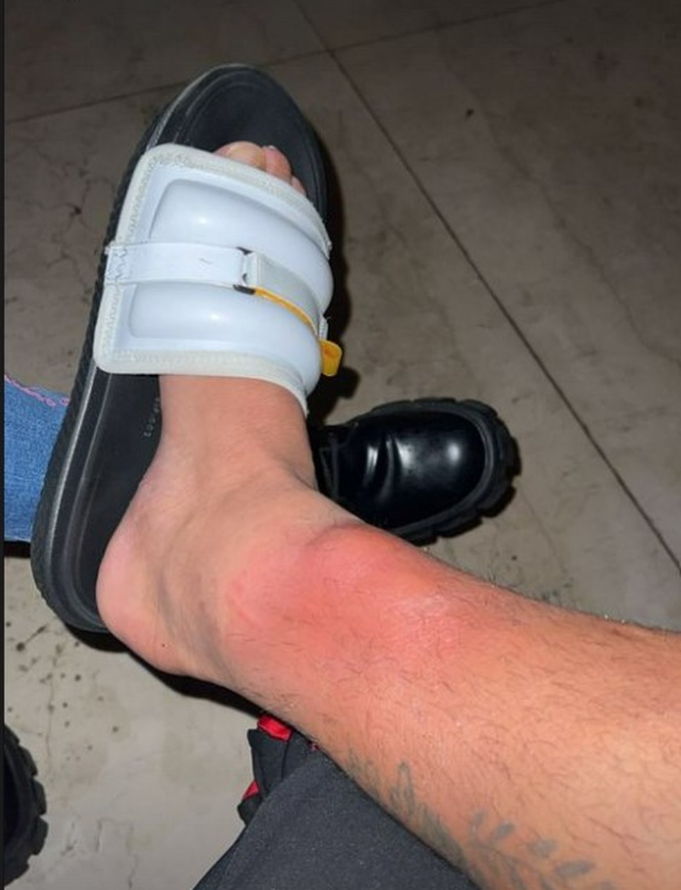 Vidal mostra o estado de sua perna ap&oacute;s o Flamengo x Corinthians &mdash; Foto: Reprodu&ccedil;&atilde;o