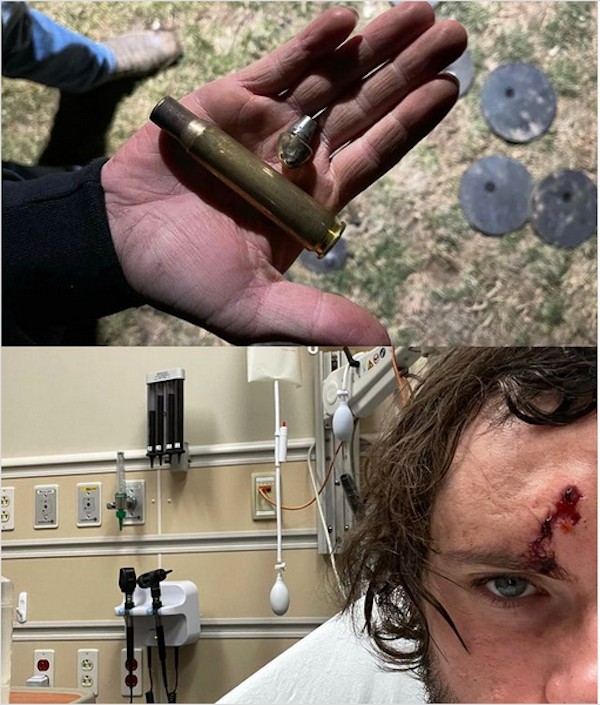 O youtuber WhistlinDiesel com a testa ferida após ser atingida por uma bala calibre ponto 50 saída de uma arma que ele atirou (Foto: Instagram)