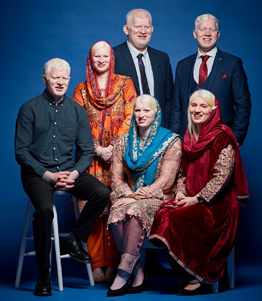 Família Coventry entrou para o Guinness World Records por ter o maior número de irmãos com albinismo (Foto: World Guinness Records)