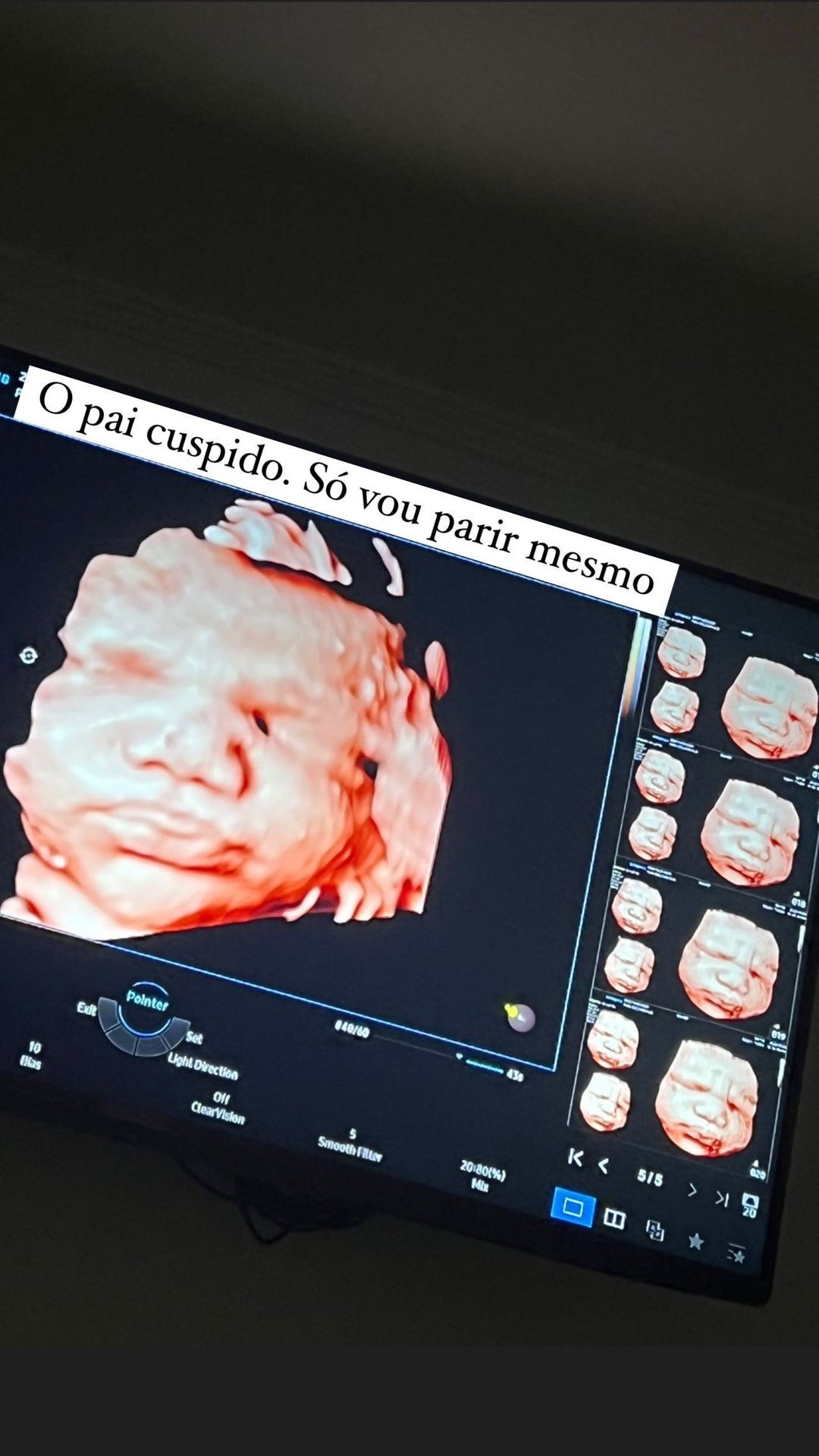 Gabriela Pugliesi mostra ultrassom na reta final da gravidez e brinca sobre semelhança com Túlio Dek (Foto: Reprodução/Instagram)