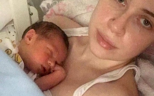 Bebe Morre Depois De Contrair Herpes Da Mae Revista Crescer Saude