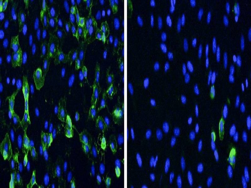 À esquerda, estão as células (em azul) infectadas pelo Sars-CoV-2 (em verde) sem nenhum tipo de tratamento; na direita, estão células que foram tratadas com o peptideo,resultando em uma menor replicação viral  (Foto:  Eduardo Cilli)