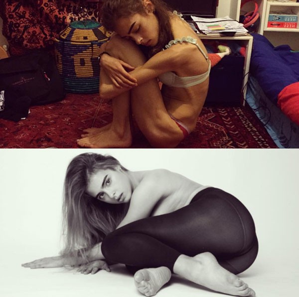 Margherita Barbieri durante e depois da anorexia (Foto: Reprodução Instagram)