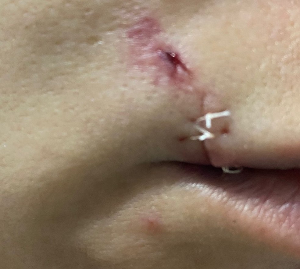 Mulher levou mais de 130 pontos após ser atingida pelo filho com golpes de estilete em Salvador — Foto: Arquivo pessoal