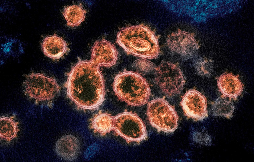 Imagem microscópica de partículas de coronavírus — Foto: NIAID-RML via AP