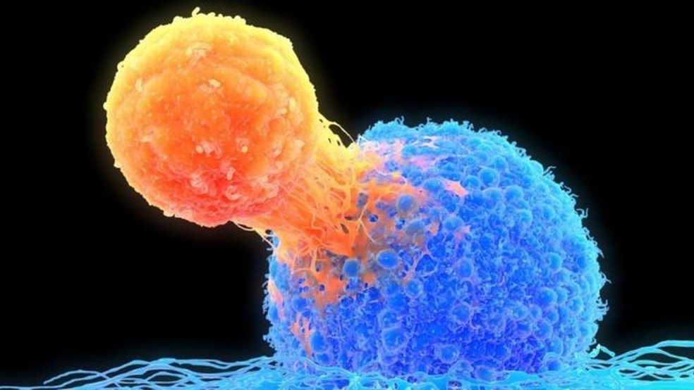 O tratamento incentiva as células T (em laranja) a atacar as células cancerígenas (à dir., em azul) — Foto: Getty Images via BBC