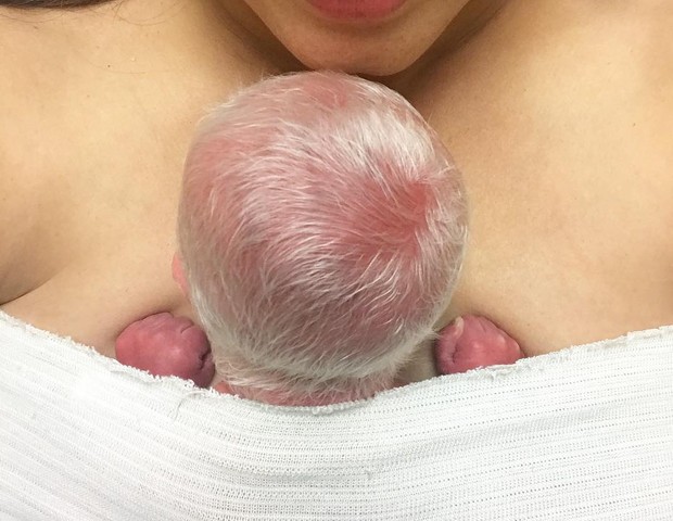 Bebê albino (Foto: Reprodução Instagram)