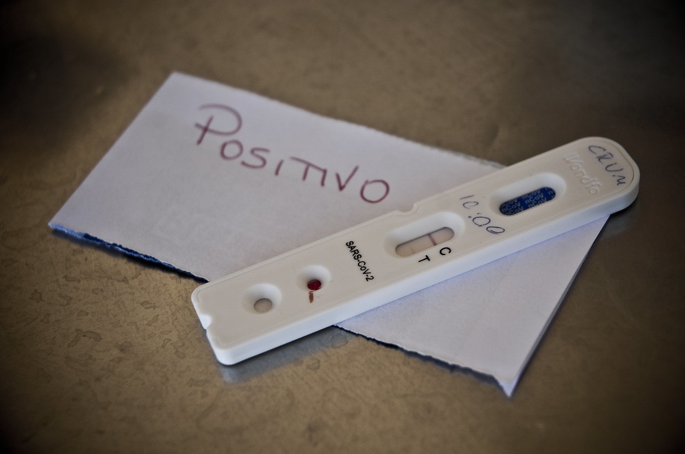 Laboratório aplica testes de coronavírus em pacientes. — Foto: Breno Esaki/Agência Saúde