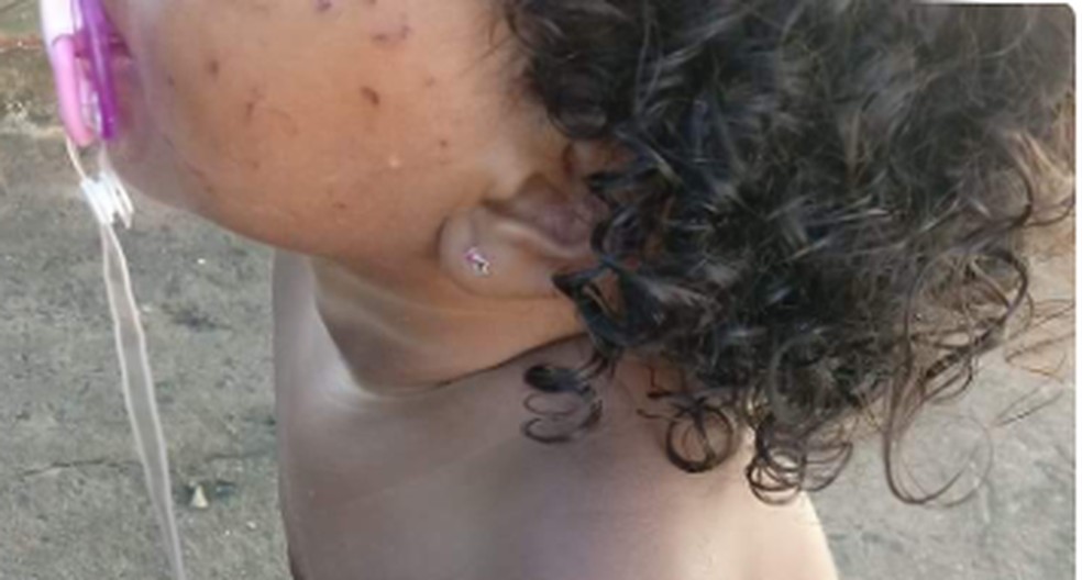Desde que ocorreu os arranhões na criança, a tia tem deixado Pietra sob os cuidados de uma parente  — Foto: Arquivo Pessoal 