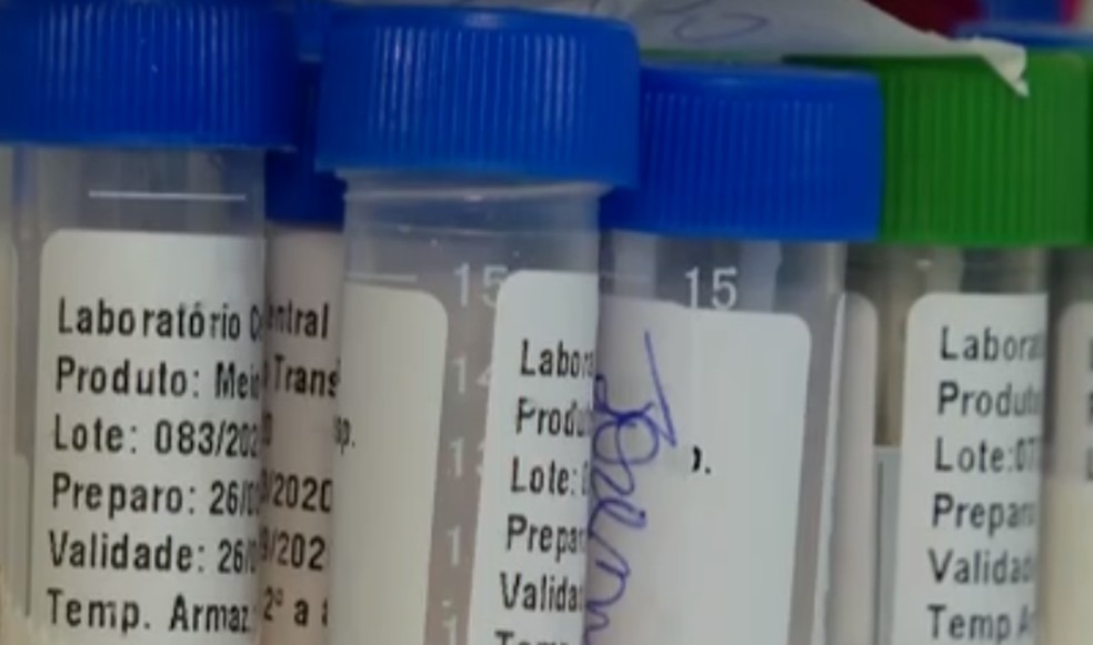 Testes da Covid-19 em laboratório — Foto: Reprodução/ TV Globo