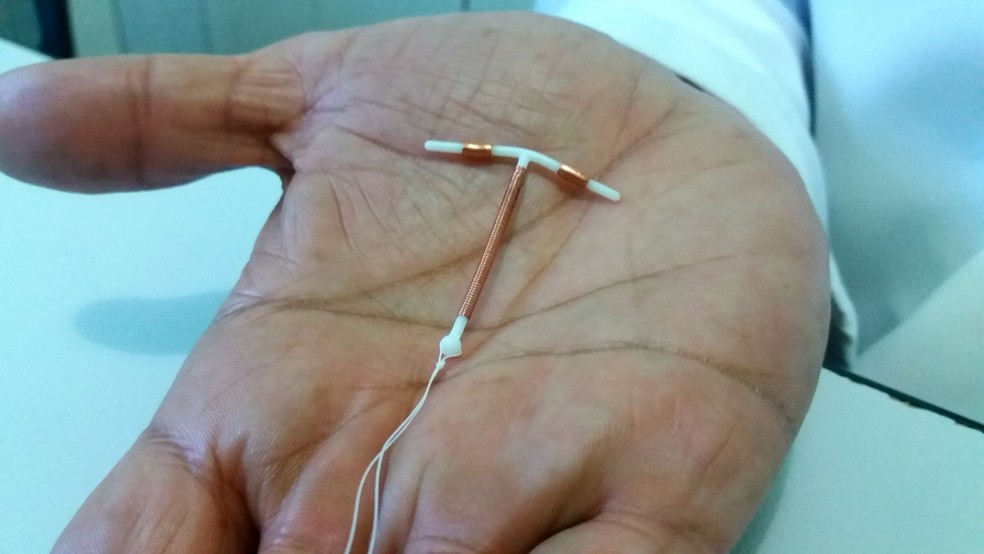 DIU de cobre tem validade de 3 a 10 anos, dependendo da data de esterilização do item — Foto: Fabiana Figueiredo/G1