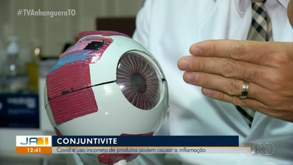 Covid-19 e uso incorreto de produtos podem causar conjuntivite