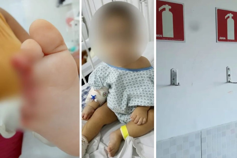 Bebê de 1 ano teve dois dedos decepados após extintor de incêndio cair em cima do pé dele dentro de creche — Foto: Reprodução