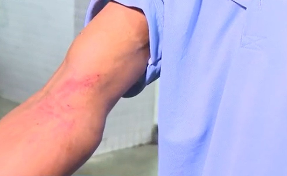 Trabalhador é resgatado de cárcere privado com marcas de agressões em Salvador — Foto: Reprodução/TV Bahia