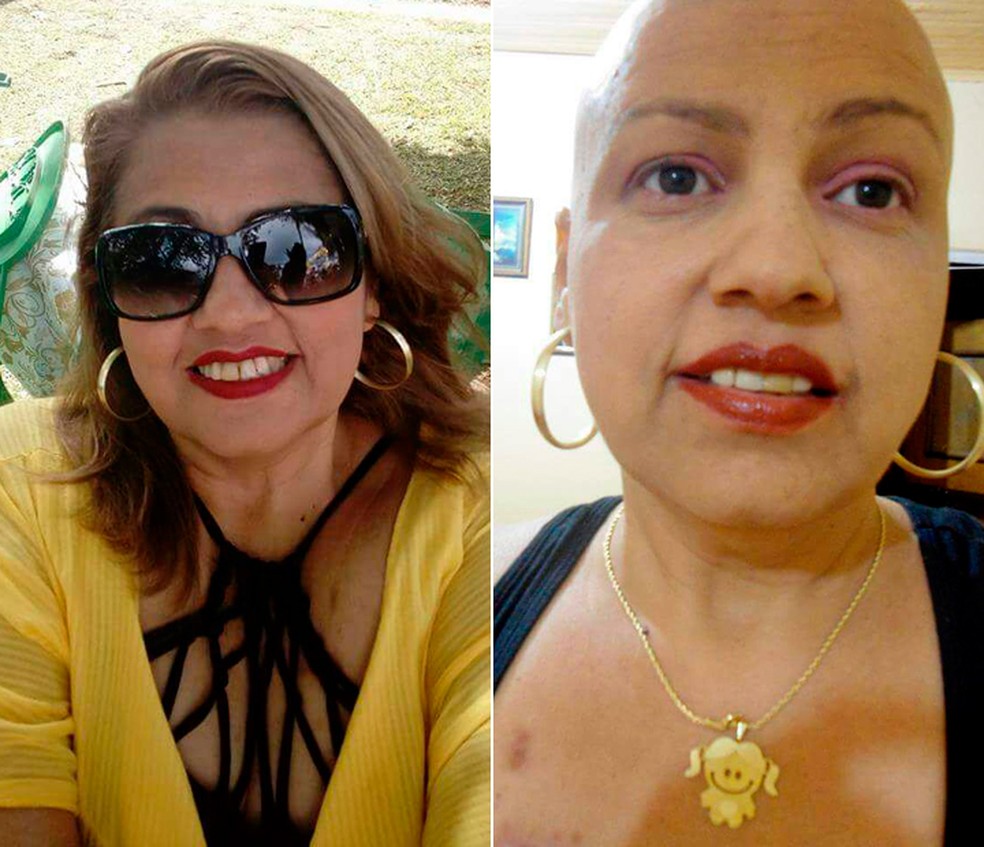 Baiana Nilza Batista, de 47 anos, descobriu câncer após bariátrica e, após tratamento, conseguiu se curar (Foto: Arquivo pessoal)