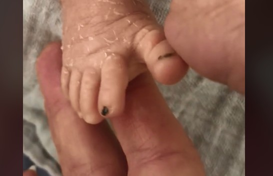 Mãe usa esmalte nas unhas dos pés de gêmeos para diferenciá-los (Foto: Reprodução/Tik Tok)