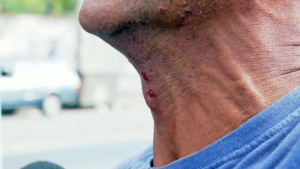Jaime foi atingido de raspão — Foto: Reprodução/TV Globo