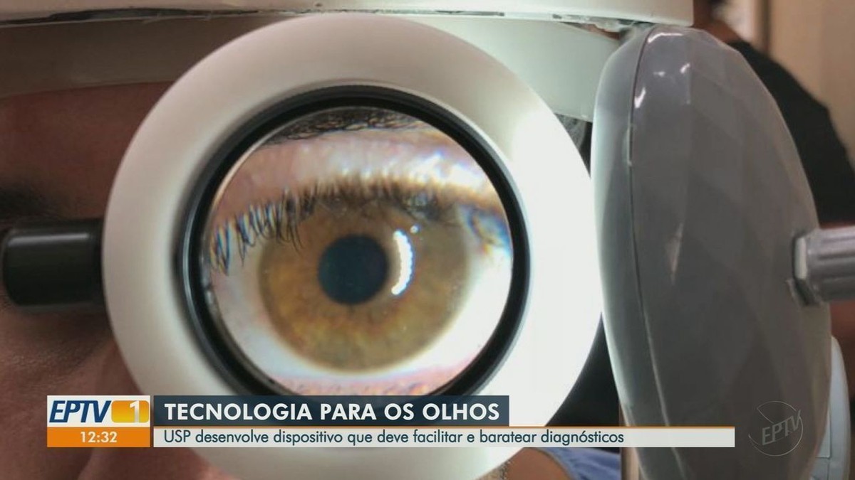La technologie développée à l’USP est capable d’examiner les yeux avec un téléphone portable et de rendre la procédure plus accessible |  Ribeirao Preto et la France