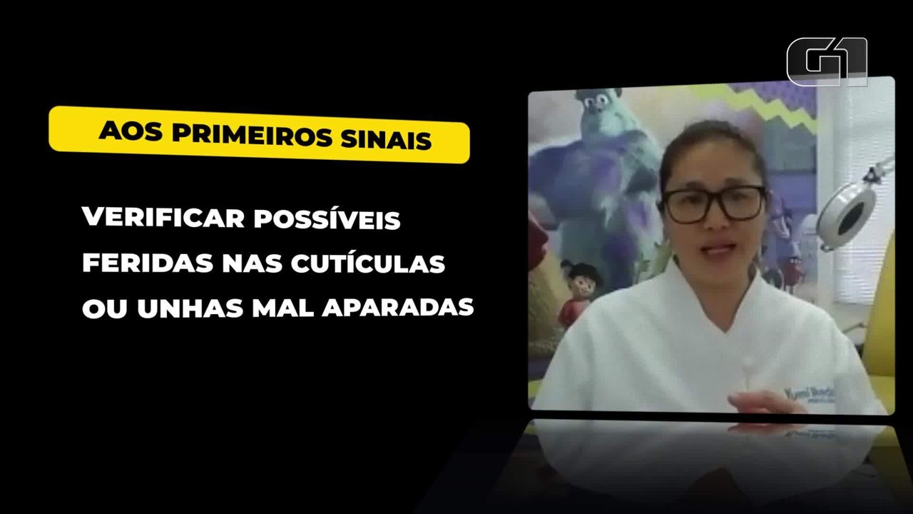 Onicofagia: hábito de roer unhas tem relação com questões psicológicas