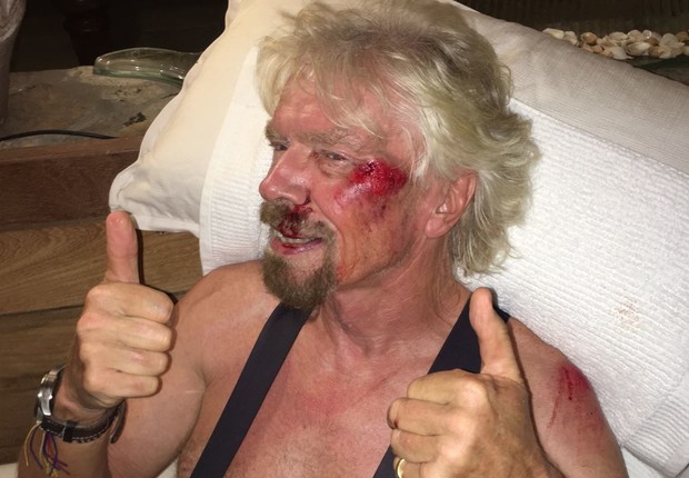 Richard Branson sofre acidente de bicicleta (Foto: Divulgação)