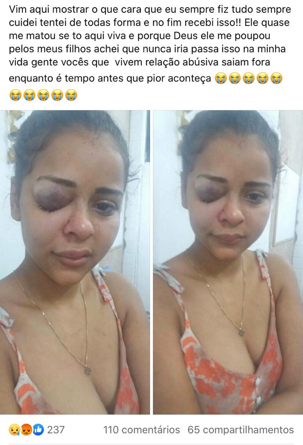 Jovem fez publicação no Facebook para divulgar agressão em relacionamento abusivo — Foto: Facebook