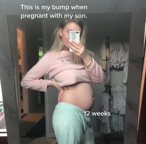 Aimee, grávida de 12 semanas (Foto: Reprodução/ TikTok)