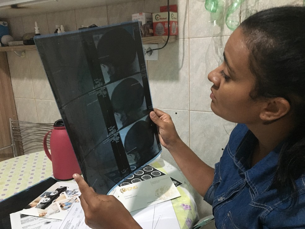 Leiliane Rafael olha um dos exames que fez para descobrir que tem doença rara — Foto: Glauco Araújo/G1