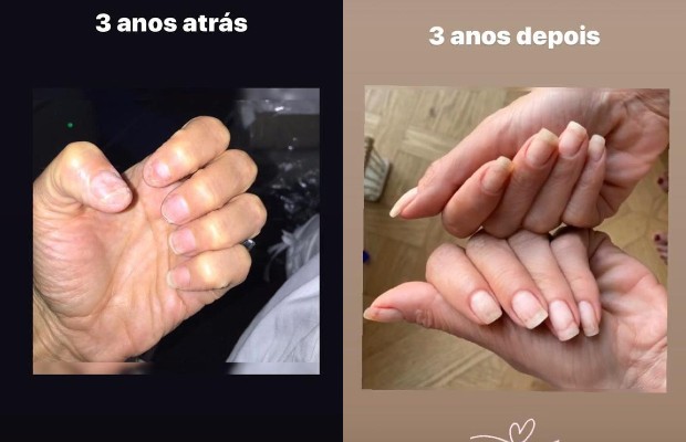 Antes e depois das unhas de Luciana Gimenez (Foto: Reprodução / Instagram)