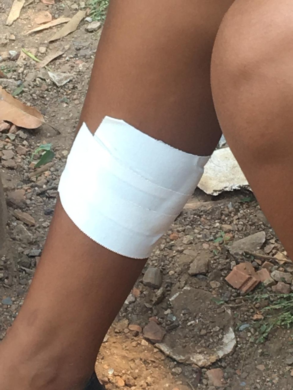 Jovem Ã© esfaqueada na perna por namorado ciumento, em CorumbÃ¡. â Foto: Gabriela Prado / TV Morena