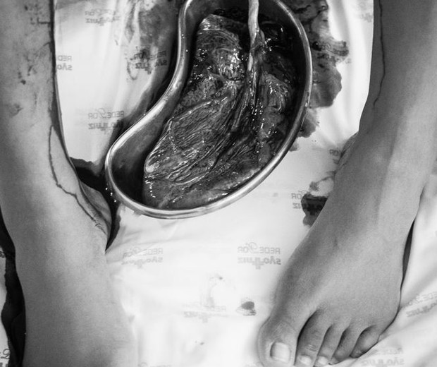 A foto da placenta que causou polêmica nas redes sociais (Foto: Line Silva)
