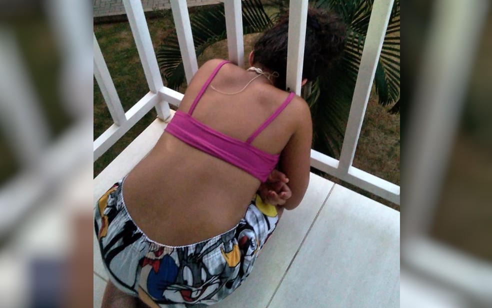 Menina com cabeça presa em grades de apartamento, em Caldas Novas, Goiás — Foto: Divulgação/CBMGO 