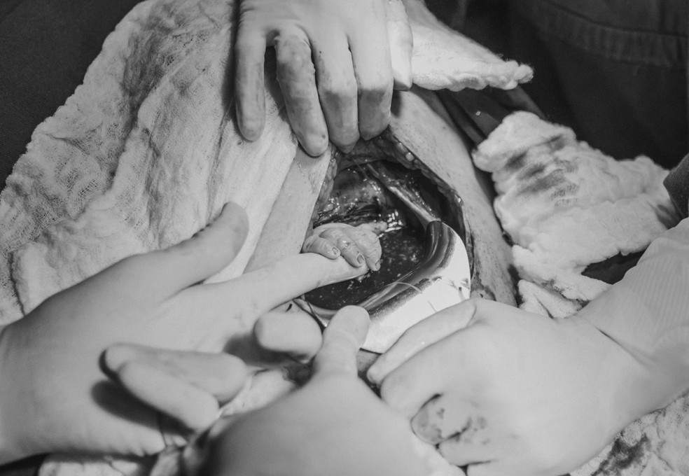 Ainda na barriga da mÃ£e, bebÃª Luana segura dedo de obstetra â€” Foto: Bruna Costa/DivulgaÃ§Ã£o
