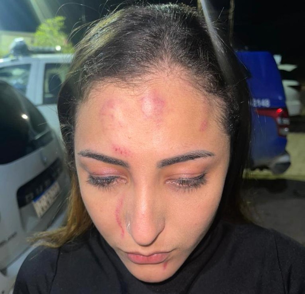 Rosto machucado da cantora Soraya Oliveira, vocalista da Banda Sedutora — Foto: Reprodução/WhatsApp