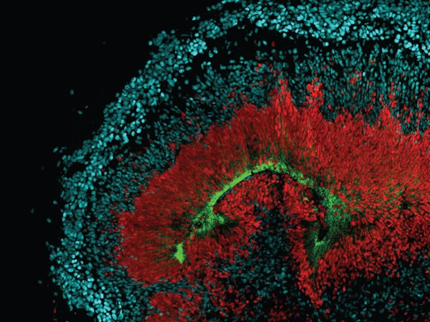  Imagem mostra minicérebro: células-tronco gliais radiais em vermelho, neurônios em azul e receptores AXL em verde (Foto: Elizabeth Di Lullo)